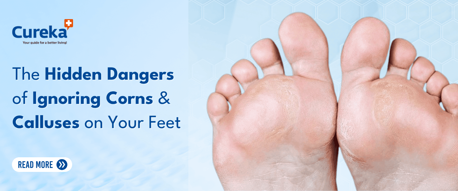 The Hidden Dangers of Ignoring Corns and Calluses on Your Feet