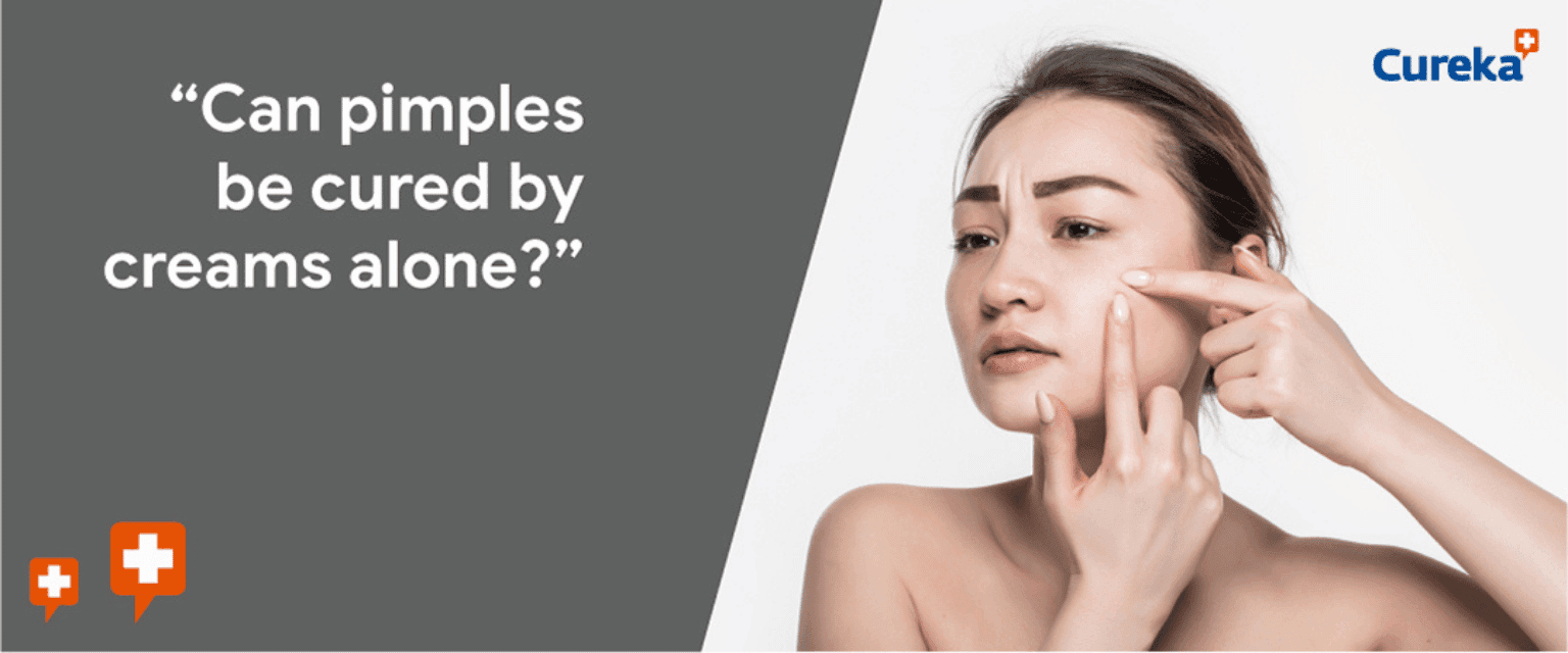 Can Pimples Be Cured By Creams Alone?