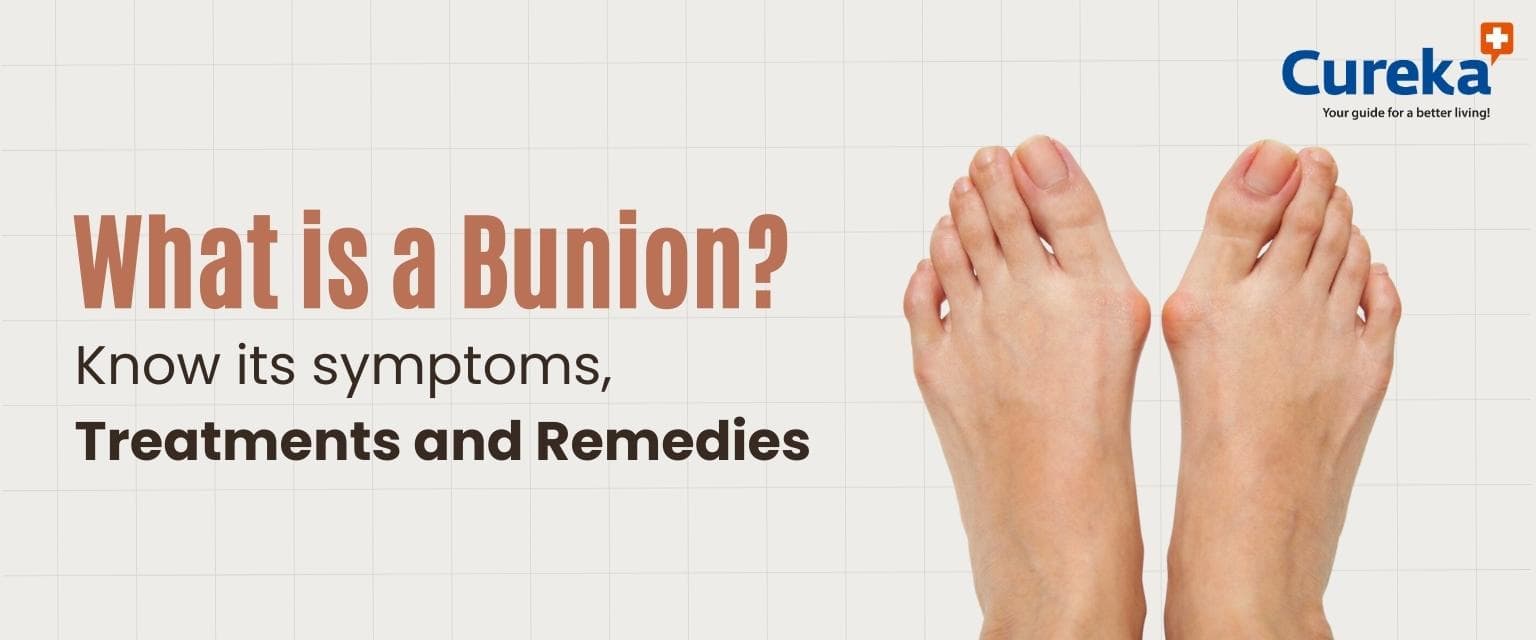 What is a Bunion? Know its Symptoms, Treatments and Remedies