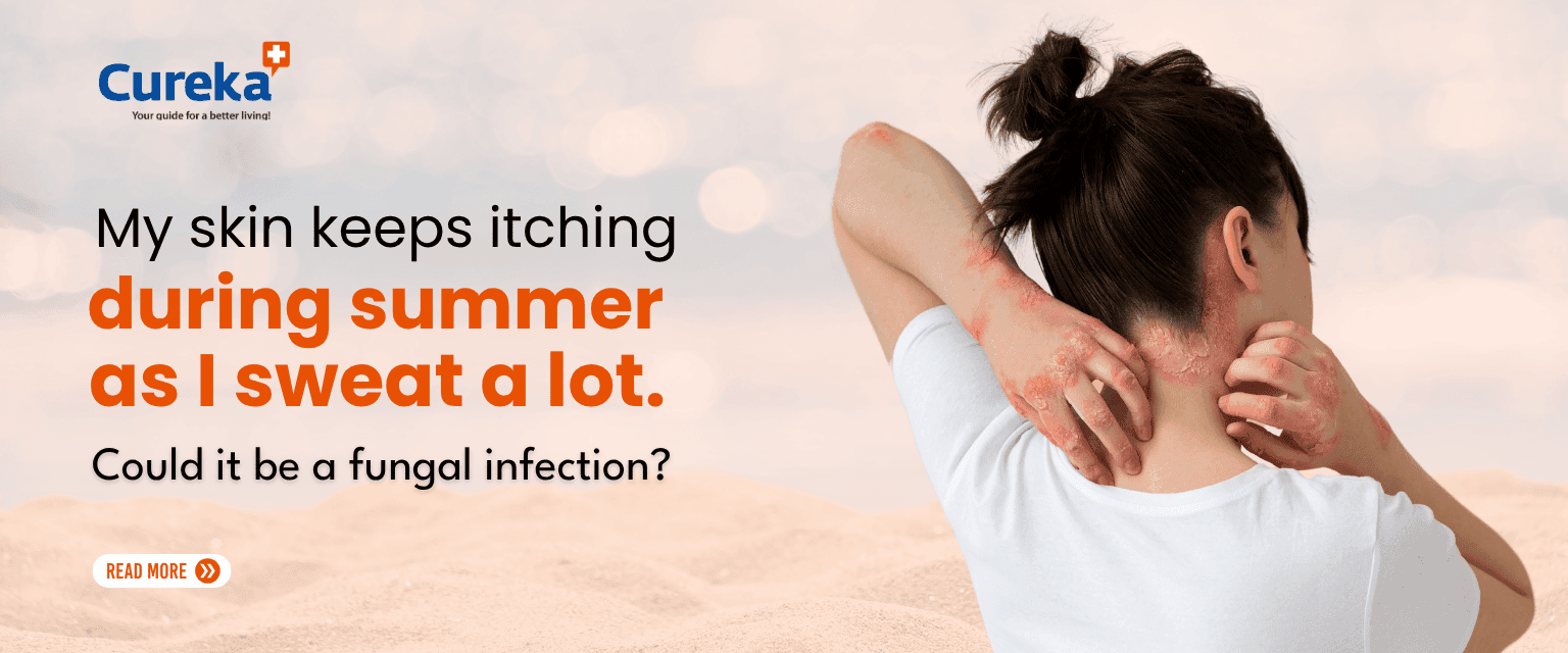 My Skin Keeps Itching During Summer as I Sweat a Lot. Could It Be a Fungal Infection?