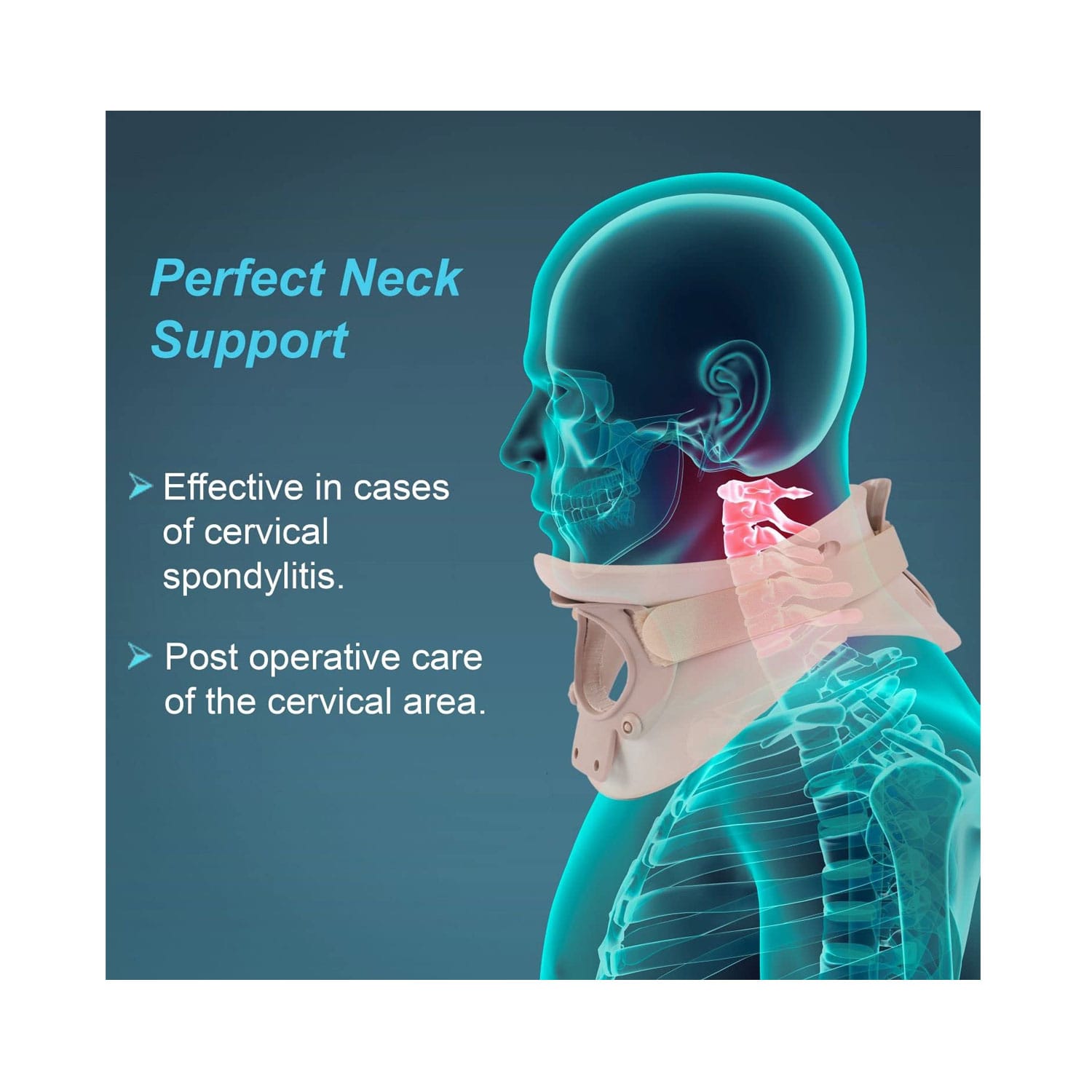 Tynor Cervical Orthosis (Philadelphia) Ethafoam - XL B-05