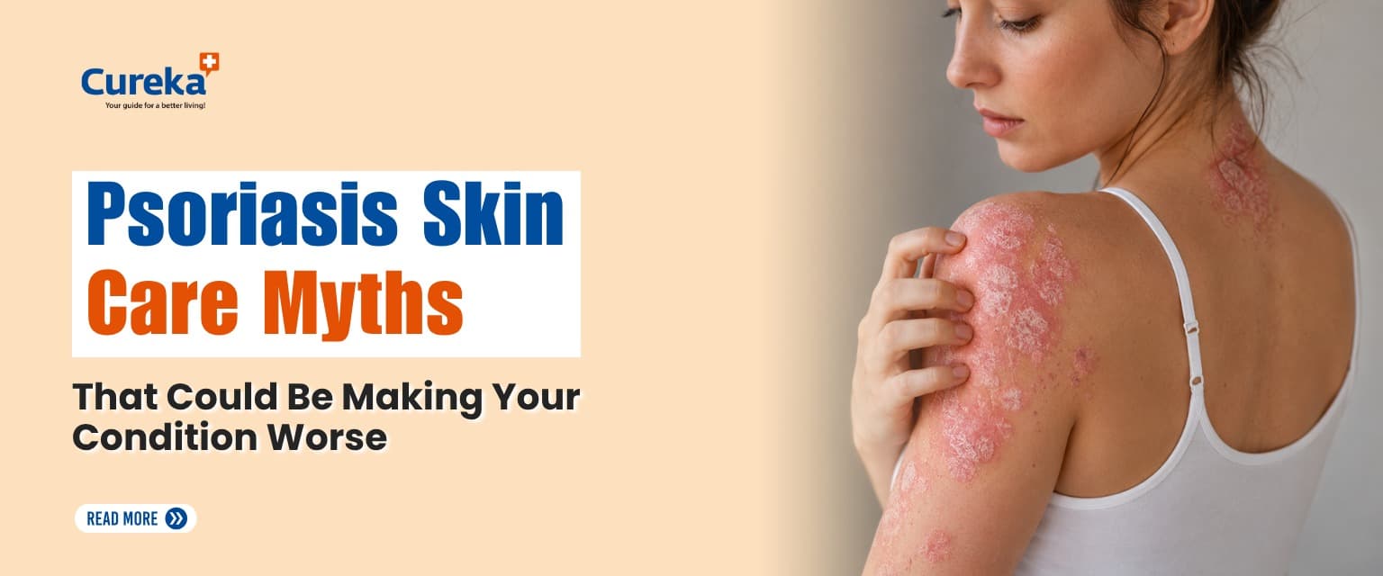 Psoriasis Skin Care Myths That Could Be Making Your Condition Worse