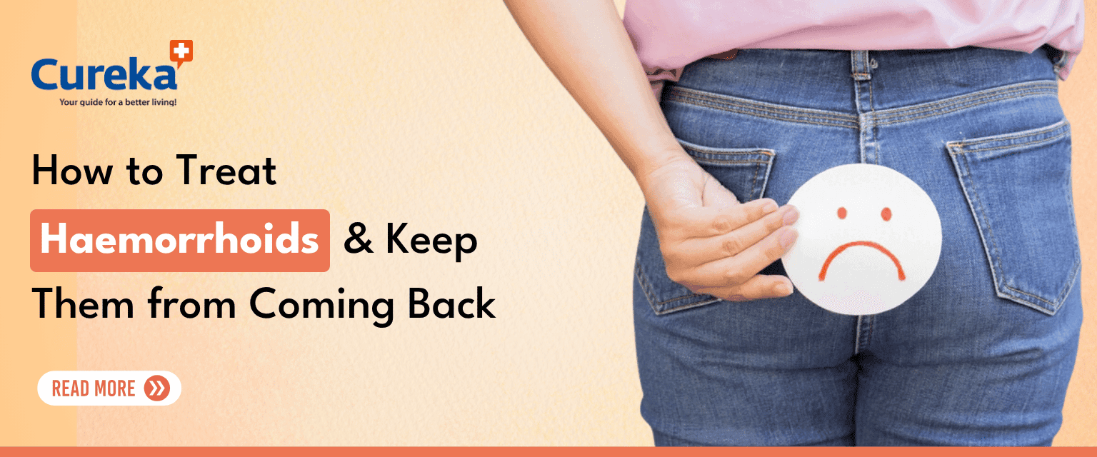 How to Treat Haemorrhoids and Keep Them from Coming Back
